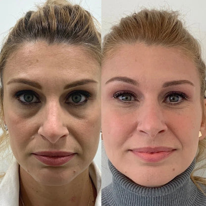 Peptide Collagen Hydrogel Eye Patch (60 Patches)