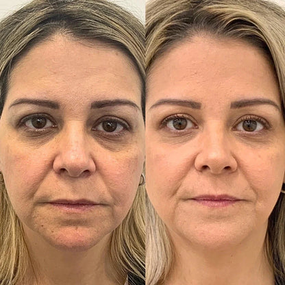 Peptide Collagen Hydrogel Eye Patch (60 Patches)