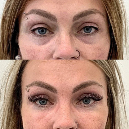 Peptide Collagen Hydrogel Eye Patch (60 Patches)